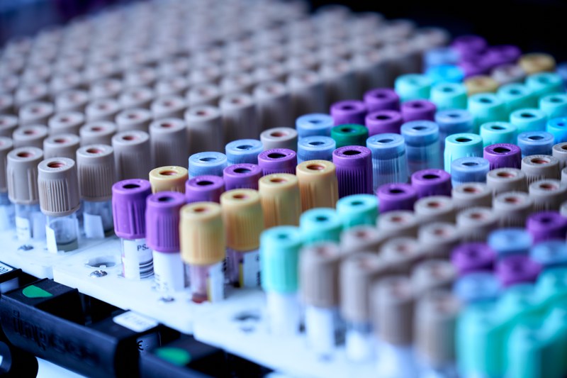 Picture of a series of colourful caps on test tubes with the focus placed on the ones at the centre of the image.