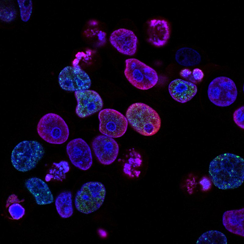 Picture of microbial cancer cells shown as purplish oval figures with a blue circle inside them in a black setting. 